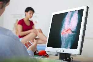 el diagnóstico de la osteoartritis