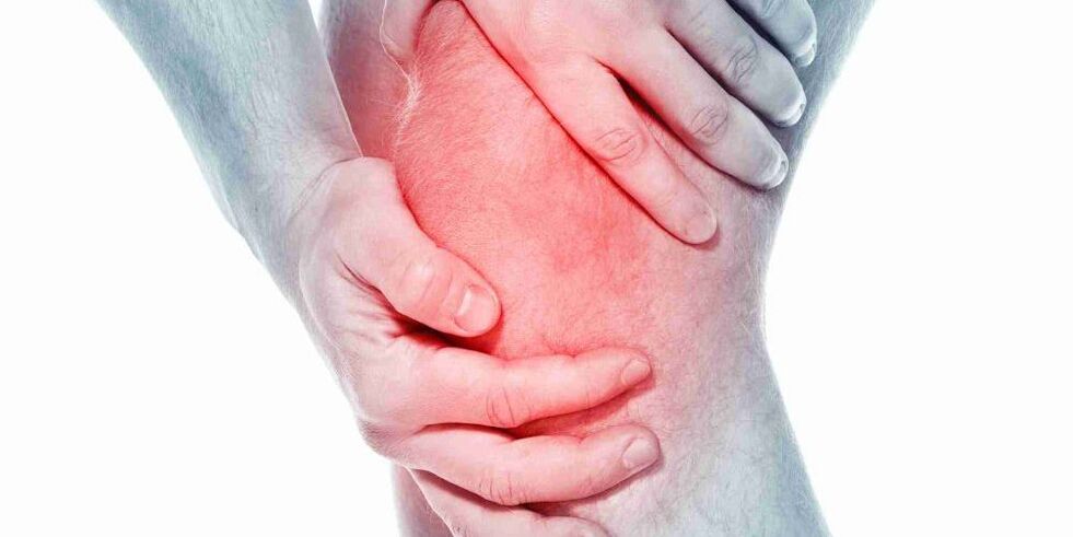 El dolor en una rodilla doblada o recta es un síntoma de artrosis de la articulación de la rodilla