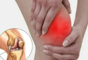 Lo que ocurre cuando la artritis